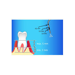 PROPHYFLEX 4 PERIO KIT + PROPHYFLEX PERIO POWDER
