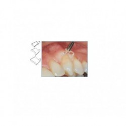 RETRACTORES GINGIVALES LM surtido 90 ud