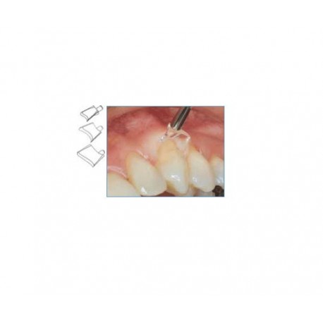 RETRACTORES GINGIVALES LM surtido 90 ud